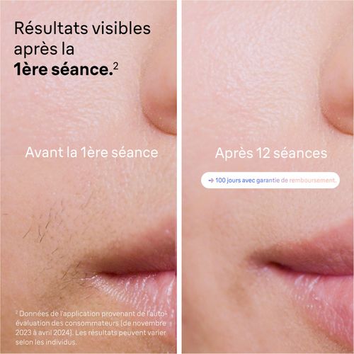 Epilateur à Lumiere Pulsée - Ipl Pl7253 - 240 V - 400 000 Flashs - Or Rose / Blanc